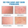 EELHOE Hyaluronic Acid Face Serum, Moisturizing Lighten Acne Mark Skin Care Essence